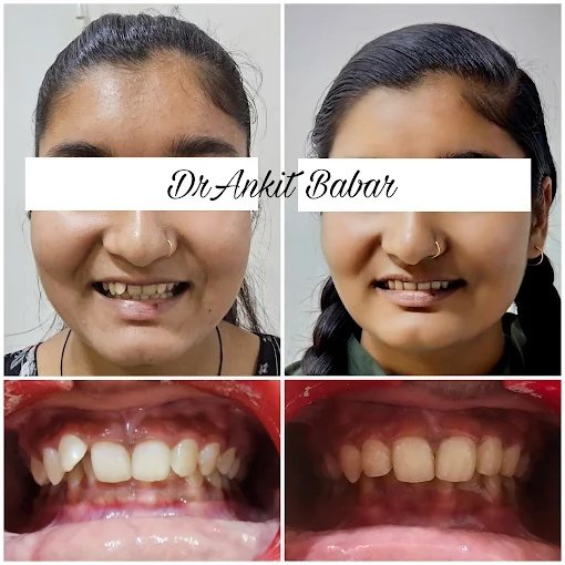 Orthodontic Smile Makeover